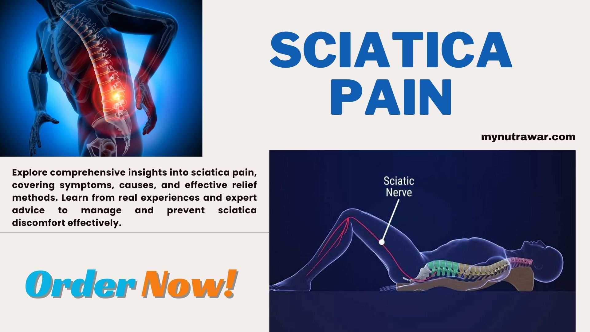 Sciatica pain